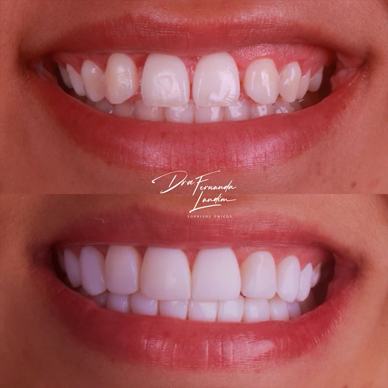 carrossel-facetas-em-resina-1