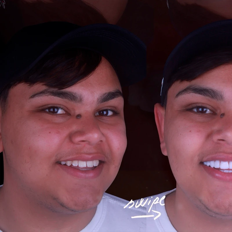 carrossel-facetas-em-resina-3