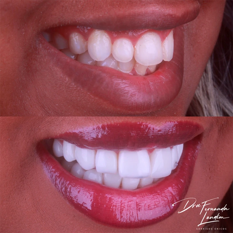 carrossel-facetas-em-resina-6