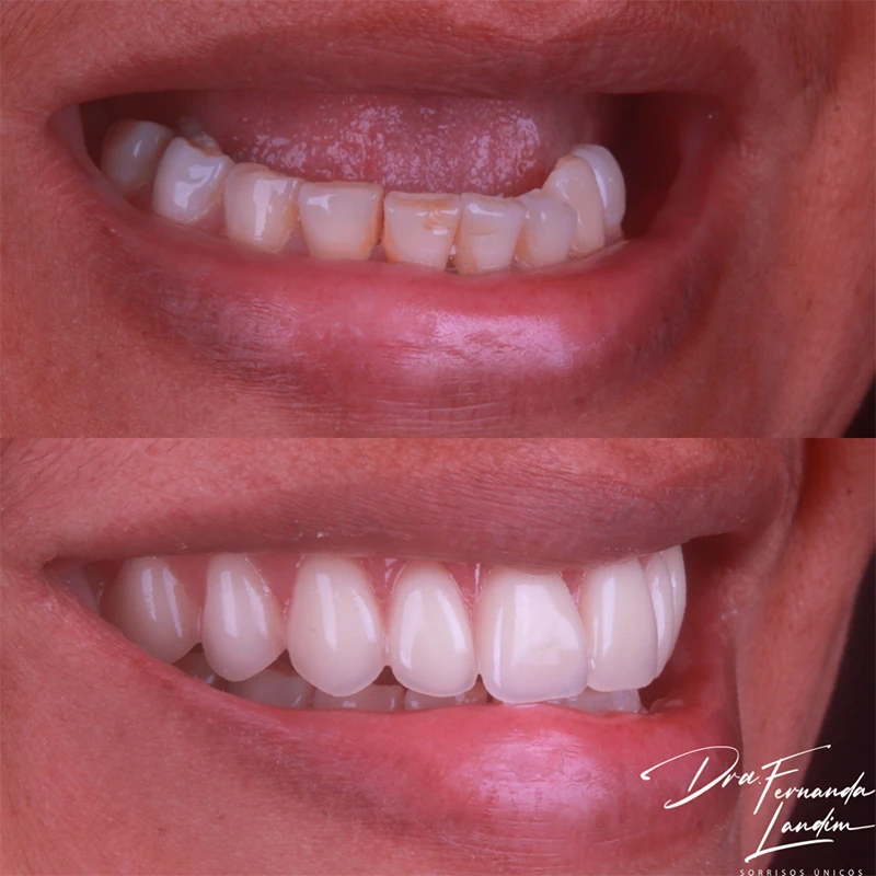 carrossel-implantes-dentarios-8